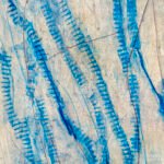 Jellyfish – Fragile